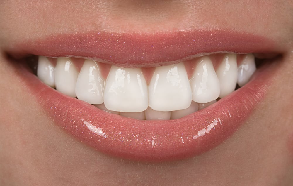 White teeth smile